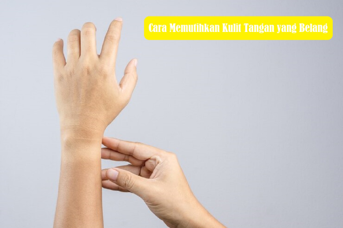 8 Cara Ampuh Memutihkan Kulit Tangan Belang? Terbukti Cepat dan Mudah, Simak Ulasannya Hingga Tuntas!