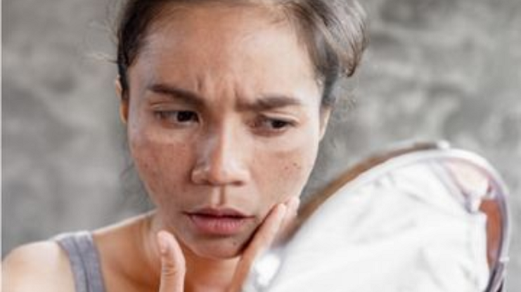 Produk Skintific Paling Cocok Atasi Flek Hitam, Simak Ulasan Lengkapnya Disini