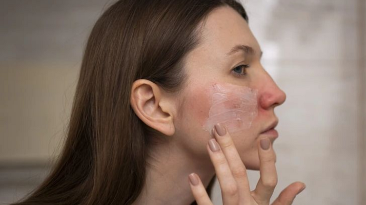  Begini Perawatan Wajah Paling Efektif Untuk Kulit Beruntusan Sampai Jerawatan
