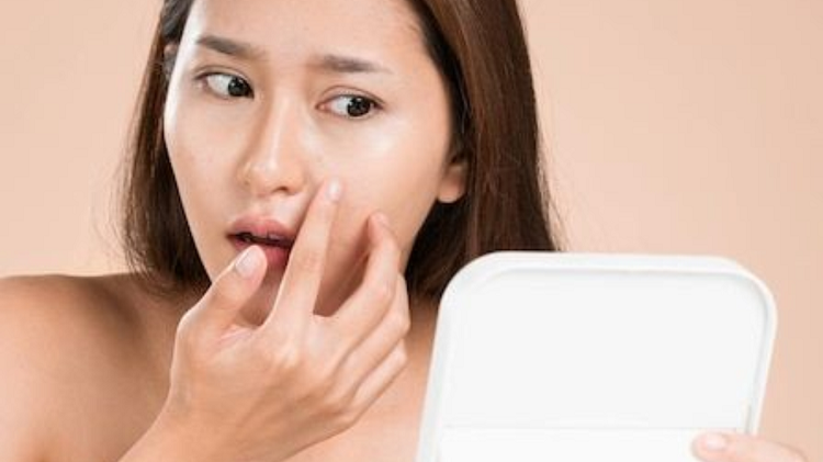 Rekomendasi Sunscreen Paling Aman Untuk Kulit Berjerawat