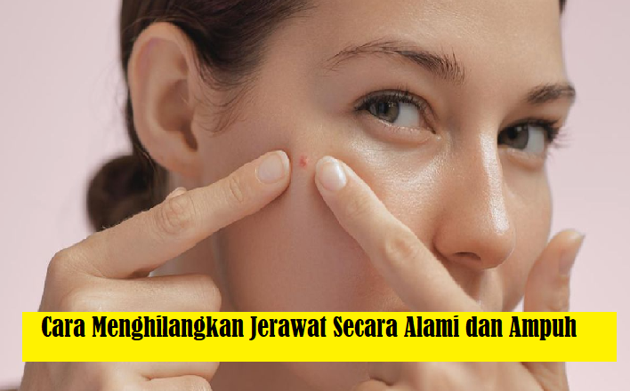 7 Cara Menghilangkan Jerawat!! Bahan Alami Jadi Rahasianya, Terbukti Ampuh Cobain Sendiri!