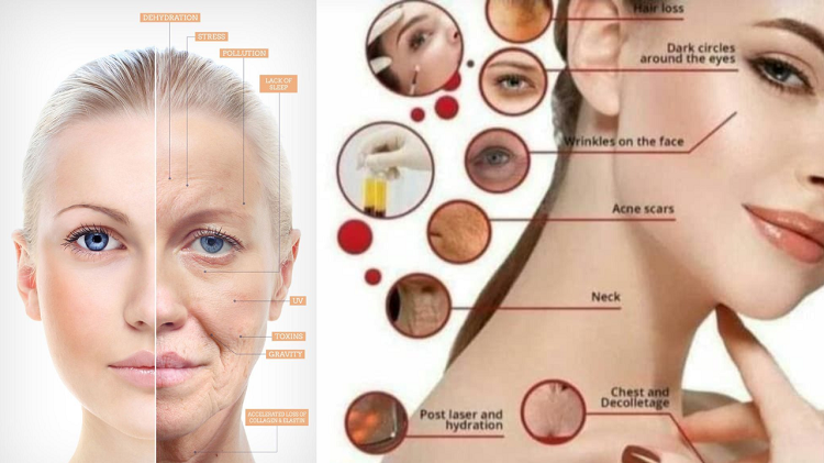 Rekomendasi dan Cara Ampuh Melawan Flek Hitam dan Tanda Penuaan pada Usia 50-an