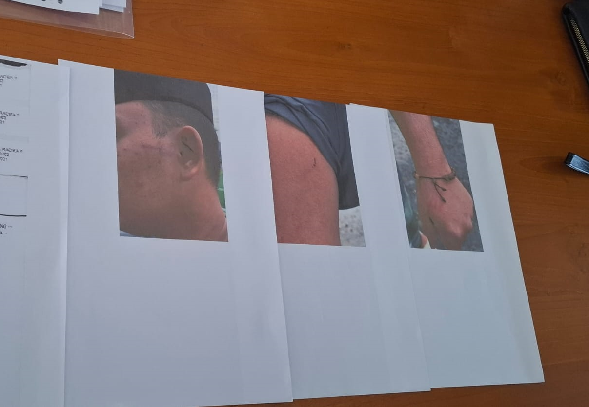 Pengurus dan Santri Diduga Lakukan Penganiayaan Sesama Santri di Ponpes Ora Aji Gus Miftah