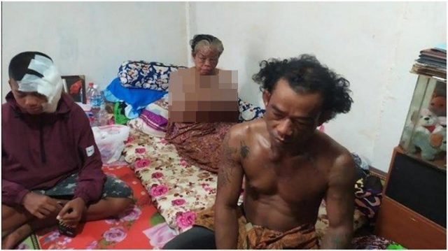 Sadis! Sekeluarga di Palembang Disiram Air Keras, Polisi Ultimatum Kurang dari 12 Jam, Pelaku 20 Orang