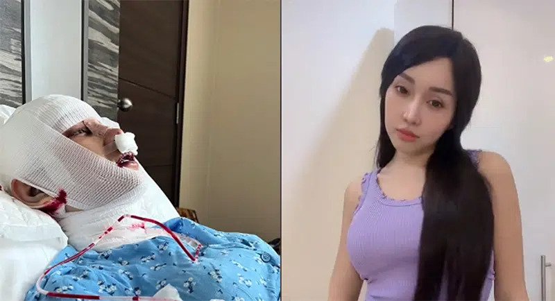 Pingin Cantik Sempurna, Lucinta Luna Operasi Lagi, Kali Ini di Leher Demi Hilangkan Khodam