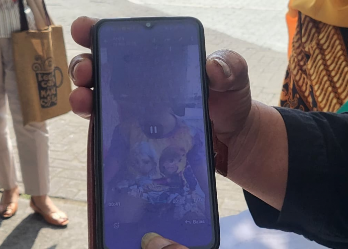 Dinkes Sleman Angkat Bicara Soal Balita Meninggal Usai CT Scan di RSUD Prambanan