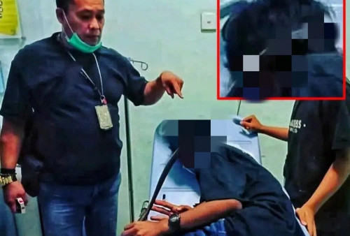 Niat Hendak Menyerang, Anggota Gengster Tertancap Celurit di Kepalanya, Berakhir di Rumah Sakit
