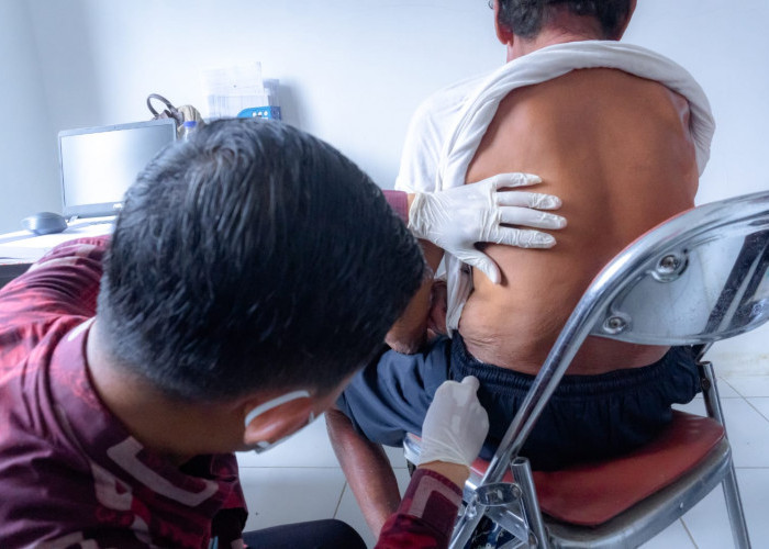 Dinkesda Brebes Dampingi Tim Kemenkes Blusukan Tangani Pasien Kusta Wilayah Cikeusal Kidul dan Kersana