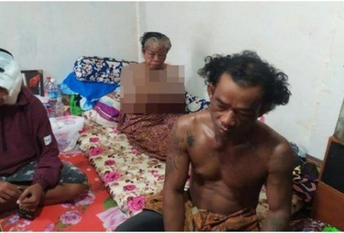 Sadis! Sekeluarga di Palembang Disiram Air Keras, Polisi Ultimatum Kurang dari 12 Jam, Pelaku 20 Orang